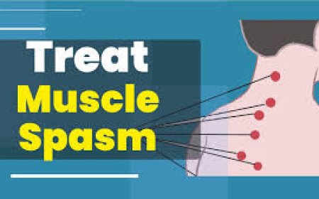 Best Muscle Spasm Medication Options for Fast Relief