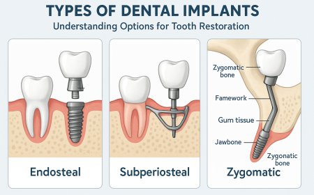 Types of Dental Implants: Understanding Options for Tooth Restoration