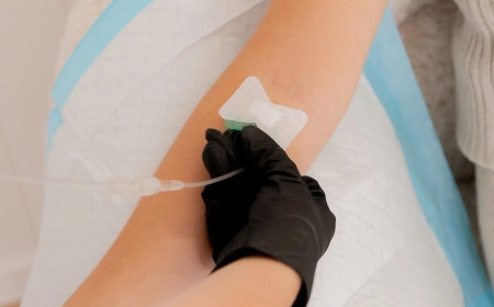 IV Drip Sydney Services Locals Are Loving for Fast Recovery