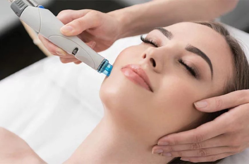 What is a Hydrafacial and How Does It Work?