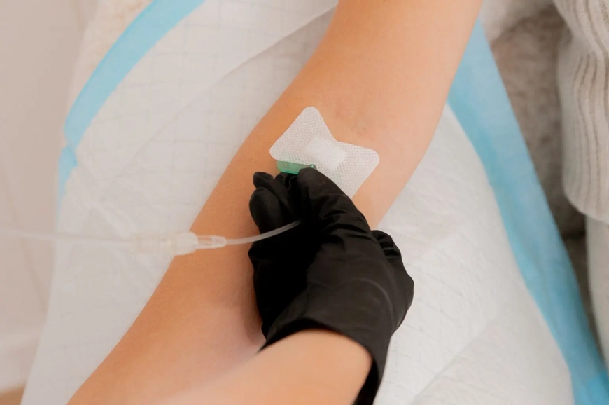 IV Drip Sydney Services Locals Are Loving for Fast Recovery